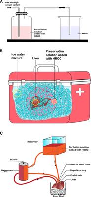 Hemoglobin-Based Oxygen Carriers: Potential Applications in Solid Organ Preservation